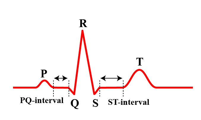 The PQ and ST intervals in the ECG